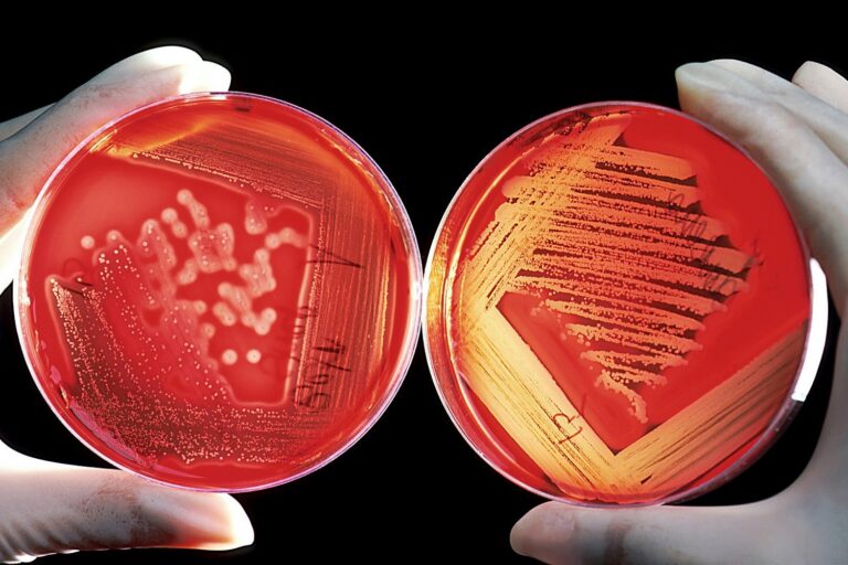 Types of parabens in cosmetics and food products